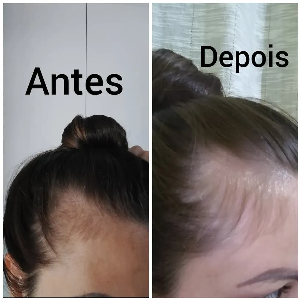 Foto do comprador — depoimento 2